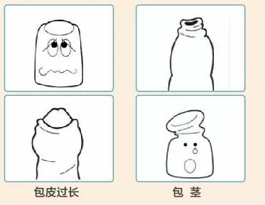 包皮手术全部费用?